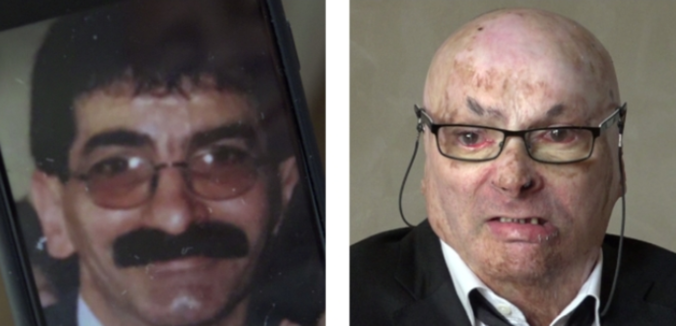 pasquale padovano, unico sopravvissuto, incidente aereo, linate, 8 ottobre 2001, prima e dopo