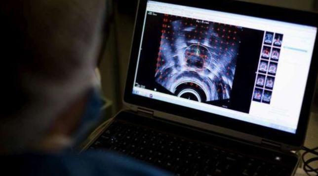 cancro analisi radioterapia esami tumore tumori