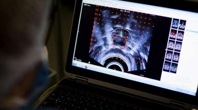 cancro analisi radioterapia esami tumore tumori