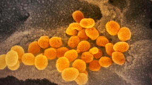coronavirus
