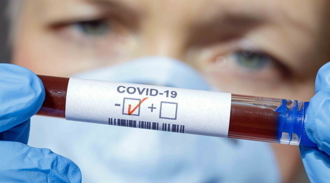 coronavirus provette test positivo