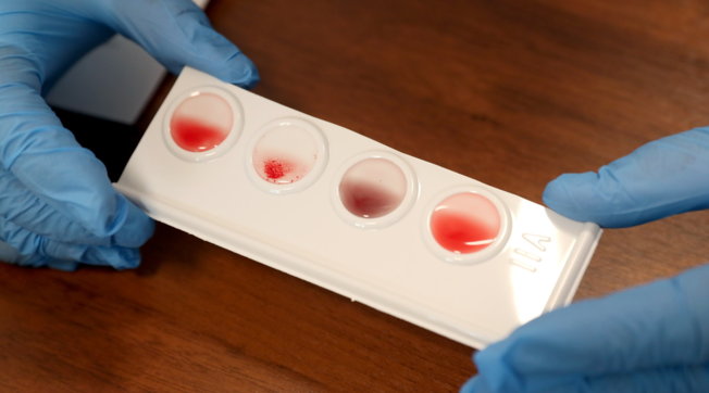 coronavirus, plasma, covid-19