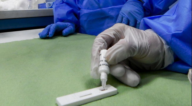 coronavirus, napoli, test rapidi