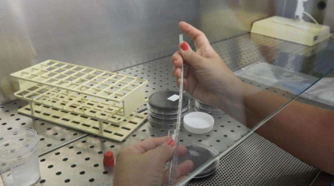 polmonite legionella