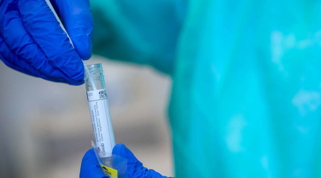 coronavirus generica generico medico tampone mascherina mascherine