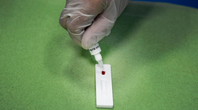 coronavirus, napoli, test rapidi