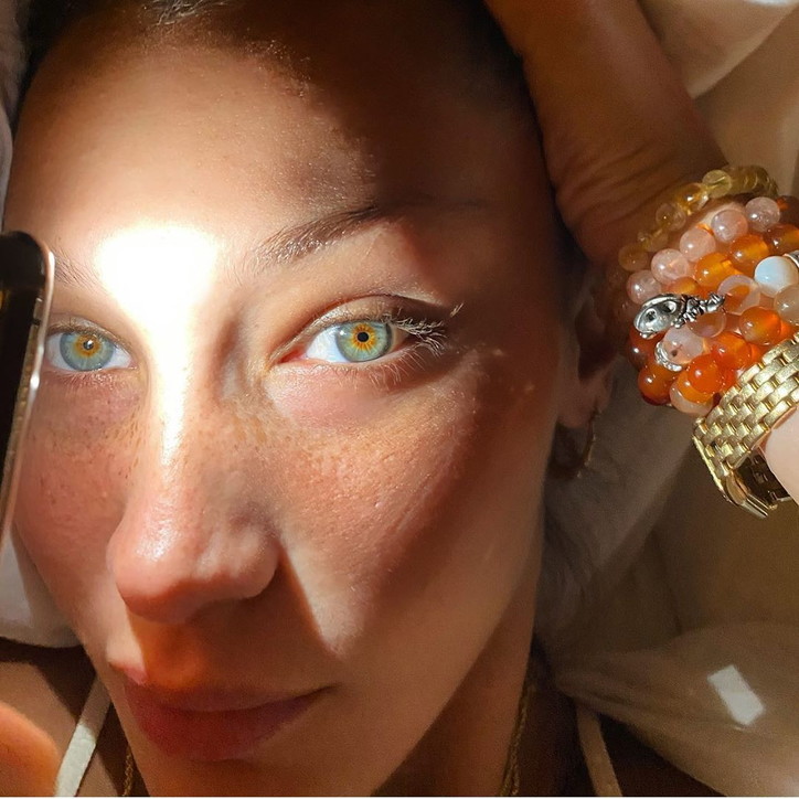 Bella Hadid E La Malattia Di Lyme