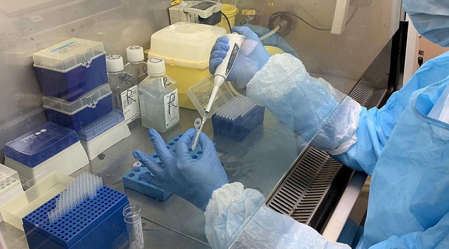 coronavirus, test salivare rapito, daily tampon