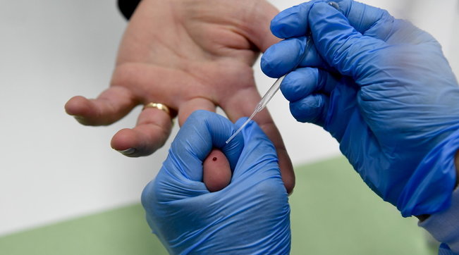 coronavirus, napoli, test rapidi