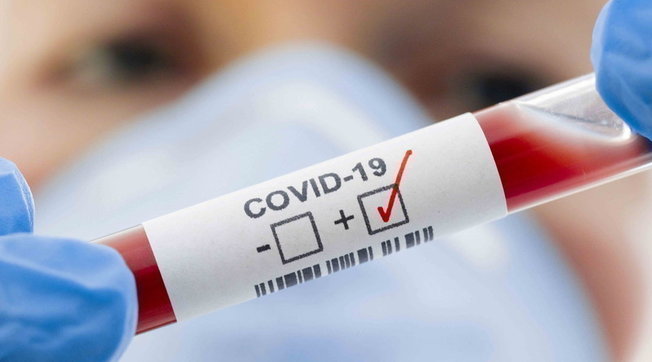 In Abruzzo decine di casi di coronavirus da sospette varianti