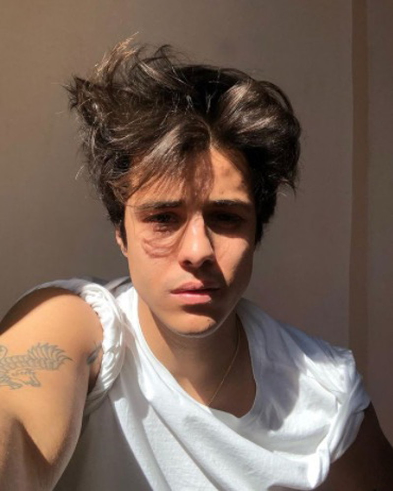 Addio Michele Merlo, il cantante di "Amici" morto per un'emorragia cerebrale