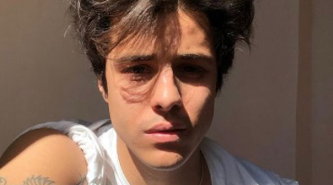 Il cantante Michele Merlo non ce l'ha fatta | Il commosso ricordo di amici e colleghi