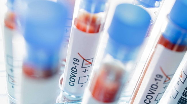 coronavirus provette test positivo