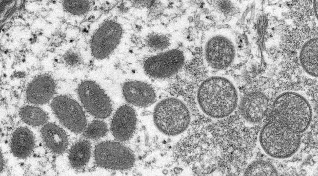 vaiolo delle scimmie monkeypox