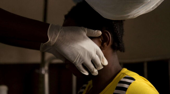vaiolo delle scimmie monkeypox