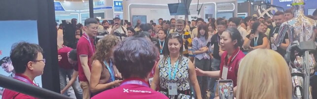Cina, donna con distrofia muscolare torna a camminare grazie all'esoscheletro