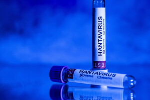 Hantavirus, circolare del Ministero, quarantena di 42 giorni per contatti ad alto rischio