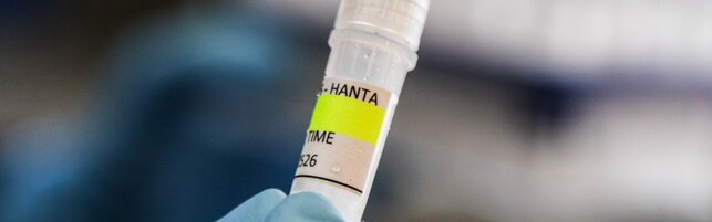Anteprima: Hantavirus: sei casi sospetti in Italia, negativi i due stranieri in quarantena tra Milan…