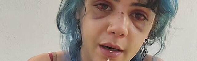 Nuova denuncia per aggressione da parte di una studentessa a Bari