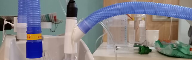 Beatrice, la 14enne morta nel 2021 per guasto al respiratore: chiesto l'omicidio volontario per la madre